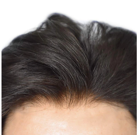 Men's Toupee/ Hair Topper - 100% Human Hair